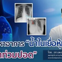 หยุดปัญหาอาการ “น้ำในเยื่อหุ้มปอด” หรือ “น้ำท่วมปอด”