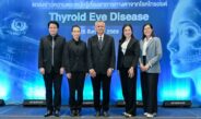 แพทย์เตือน ผู้ป่วยไทรอยด์อย่ามองข้ามอาการทางตา เพราะอาจเสี่ยงสูญเสียการมองเห็นTED ไม่ใช่แค่ตาโปน แพทย์ชี้โรคอาจกระทบการมองเห็นและคุณภาพชีวิต หากปล่อยไว้โดยไม่รักษา